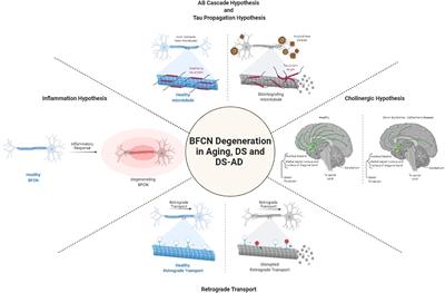 Basal Forebrain Cholinergic Neurons: Linking Down Syndrome and Alzheimer’s Disease